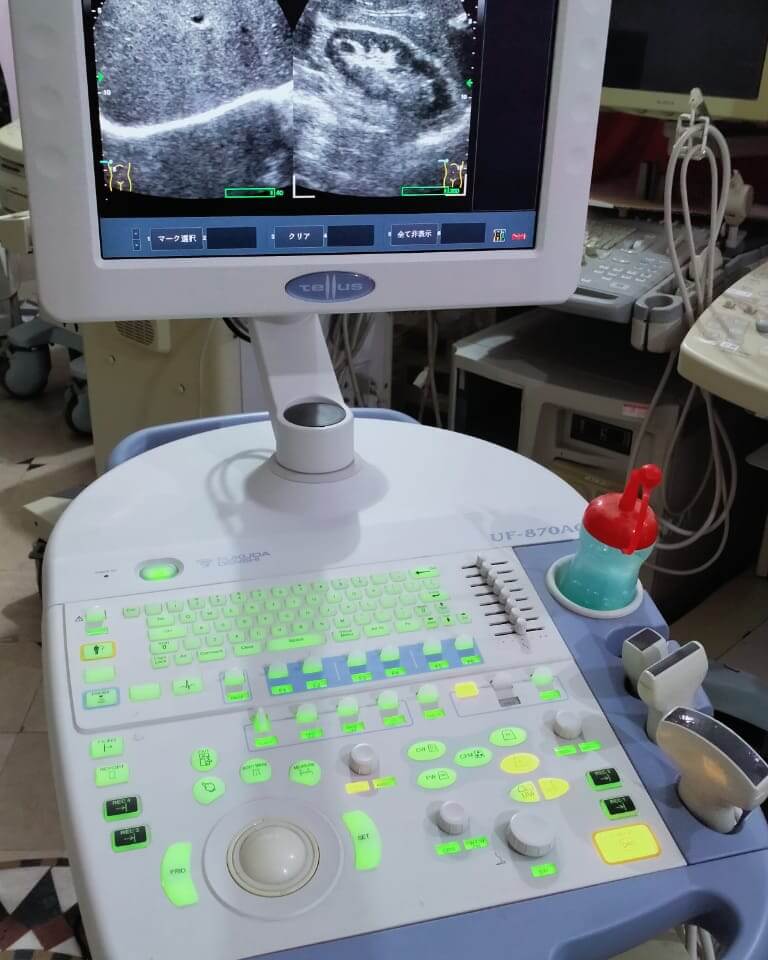Ultrasound Scanning Machine 